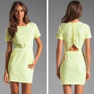 Dolce Vita Rita Yellow dress